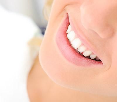 Tooth Color Filling Tooth Color Filling